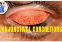 Sonoran Desert Eye Center: CONCRETION Ways To Find A Mentor In Your Industry For Guidance